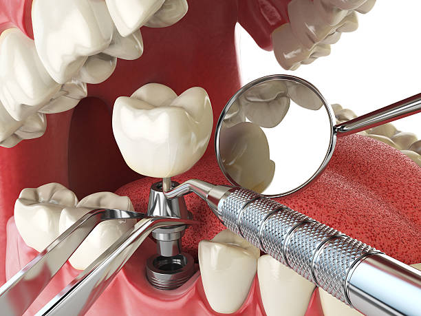 Best Orthodontic Emergency Dentist in Lake Tansi, TN
